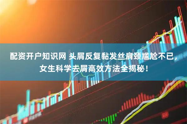 配资开户知识网 头屑反复黏发丝肩颈尴尬不已，女生科学去屑高效方法全揭秘！
